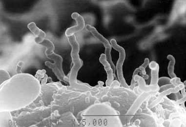 Nanobes